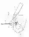 Fig. 05 - Ophthalmic surgical instrument with pre-set tip-to-shell orientation
