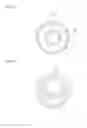 Fig. 03 - BALLOON CATHETER AND METHOD FOR PRODUCING SAME