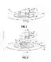 Fig. 02 - Infusion site leak detection device
