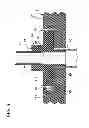 Fig. 06 - Pump set having secure loading features