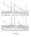 Fig. 08 - CATHETER DISCRIMINATION AND GUIDANCE SYSTEM
