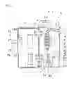 Fig. 05 - Infusion pump