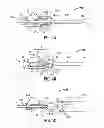 Fig. 04 - Safety Catheter
