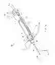 Fig. 02 - Indwelling needle device