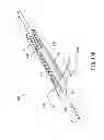 Fig. 23 - Indwelling needle device