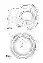 Fig. 02 - ATTACHABLE UTERINE DEVICE WITH INTEGRATED AND TIME RELEASE MEDICINAL ADMINISTERING COMPONENT AND INSERTION TOOL FOR IMPLANTING SUCH A DEVICE