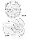 Fig. 03 - ATTACHABLE UTERINE DEVICE WITH INTEGRATED AND TIME RELEASE MEDICINAL ADMINISTERING COMPONENT AND INSERTION TOOL FOR IMPLANTING SUCH A DEVICE
