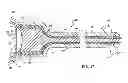Fig. 11 - ATTACHABLE UTERINE DEVICE WITH INTEGRATED AND TIME RELEASE MEDICINAL ADMINISTERING COMPONENT AND INSERTION TOOL FOR IMPLANTING SUCH A DEVICE