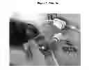 Fig. 02 - Catheter vacuum dressing apparatus and methods of use