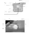 Fig. 03 - Catheter vacuum dressing apparatus and methods of use