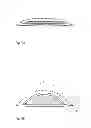 Fig. 04 - WOUND CARE ARTICLE WITH AN ENVELOPE THAT IS DEFORMABLE IN A SPECIFIC MANNER
