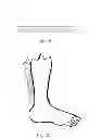 Fig. 06 - WOUND CARE ARTICLE WITH AN ENVELOPE THAT IS DEFORMABLE IN A SPECIFIC MANNER