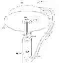 Fig. 01 - Infusion set with safety device