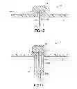 Fig. 09 - Infusion set with safety device