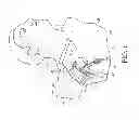 Fig. 02 - Vascular access systems having a guidewire anti-migration feature