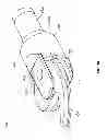 Fig. 29 - MICRO-ARTICULATED SURGICAL INSTRUMENTS USING MICRO GEAR ACTUATION