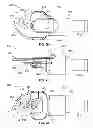 Fig. 31 - MICRO-ARTICULATED SURGICAL INSTRUMENTS USING MICRO GEAR ACTUATION