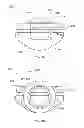 Fig. 34 - MICRO-ARTICULATED SURGICAL INSTRUMENTS USING MICRO GEAR ACTUATION
