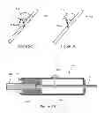 Fig. 06 - Fenestration through foreign material