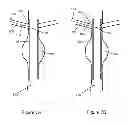 Fig. 10 - Fenestration through foreign material