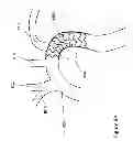 Fig. 11 - Fenestration through foreign material