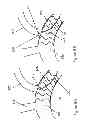 Fig. 22 - Fenestration through foreign material