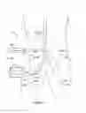 Fig. 02 - Renal nerve modulation devices and methods