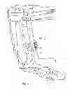 Fig. 06 - Ablation power control based on contact force