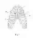 Fig. 02 - APPARATUS AND METHODS FOR SECURING TOGETHER BONE FRAGMENTS