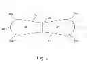 Fig. 03 - APPARATUS AND METHODS FOR SECURING TOGETHER BONE FRAGMENTS