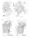Fig. 03 - Cutting tool for bone, cartilage, and disk removal