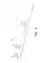 Fig. 05 - Method for cutting bone during an orthopaedic surgical procedure