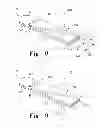 Fig. 09 - Method for cutting bone during an orthopaedic surgical procedure