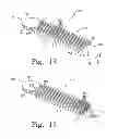 Fig. 11 - Method for cutting bone during an orthopaedic surgical procedure