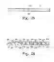 Fig. 17 - Method for cutting bone during an orthopaedic surgical procedure