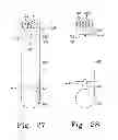 Fig. 18 - Method for cutting bone during an orthopaedic surgical procedure