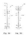 Fig. 19 - Method for cutting bone during an orthopaedic surgical procedure