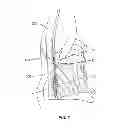 Fig. 07 - Surgical pin guide and methods of use