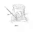 Fig. 08 - Surgical pin guide and methods of use