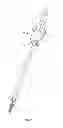 Fig. 03 - Surgical instrument and method