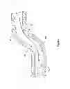 Fig. 02 - MEDICAL DEVICE HAVING AN ELECTRO-MAGNETIC DEVICE TIP AND RELATED METHOD OF USE