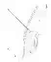 Fig. 11 - Robotic surgical devices, systems, and related methods