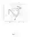 Fig. 04 - SCORING BALLOON AND APPARATUS THEREFOR