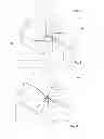 Fig. 08 - SCORING BALLOON AND APPARATUS THEREFOR