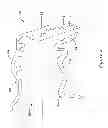 Fig. 03 - CENTERED BALLOON FOR THE LEFT ATRIAL APPENDAGE