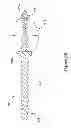 Fig. 11 - CENTERED BALLOON FOR THE LEFT ATRIAL APPENDAGE