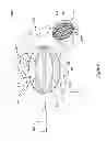 Fig. 13 - CENTERED BALLOON FOR THE LEFT ATRIAL APPENDAGE