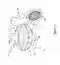 Fig. 14 - CENTERED BALLOON FOR THE LEFT ATRIAL APPENDAGE