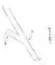 Fig. 19 - CENTERED BALLOON FOR THE LEFT ATRIAL APPENDAGE