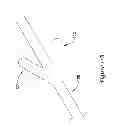 Fig. 20 - CENTERED BALLOON FOR THE LEFT ATRIAL APPENDAGE
